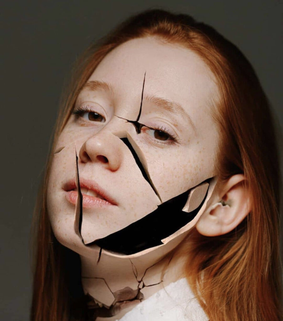 Ευαίσθητη επιδερμίδα